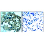 Immunohistochemistry - Merlin (Ab-518) Antibody from Signalway Antibody (21258) - Antibodies.com