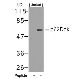 Western blot - p62Dok (Ab-362) Antibody from Signalway Antibody (21268) - Antibodies.com