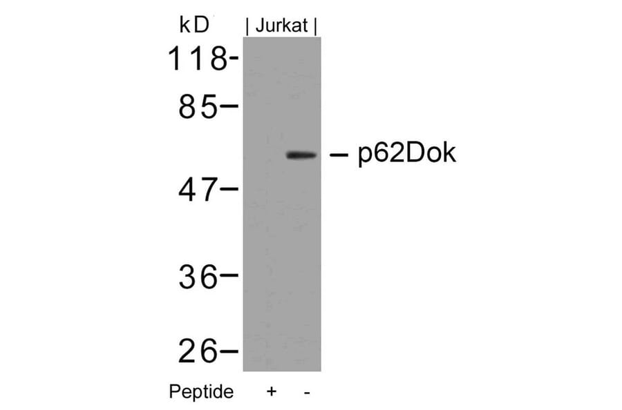 Western blot - p62Dok (Ab-362) Antibody from Signalway Antibody (21268) - Antibodies.com