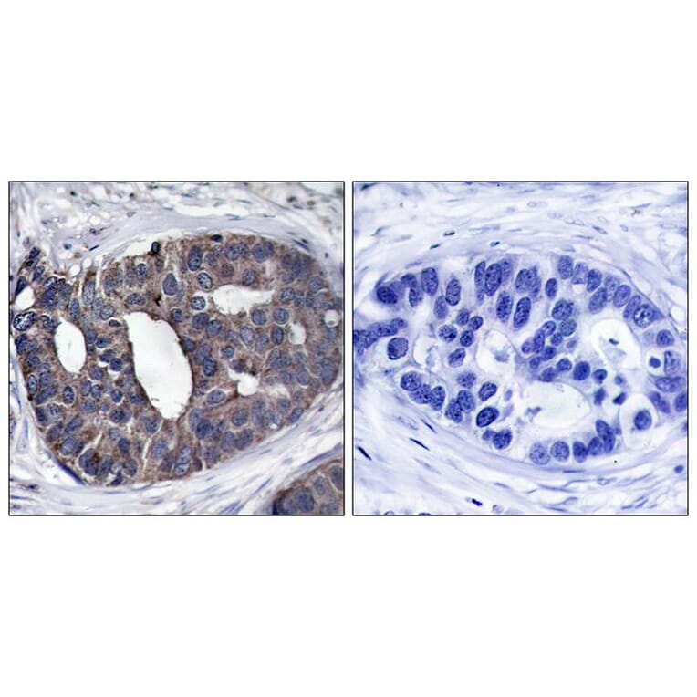 Immunohistochemistry - p62Dok (Ab-362) Antibody from Signalway Antibody (21268) - Antibodies.com