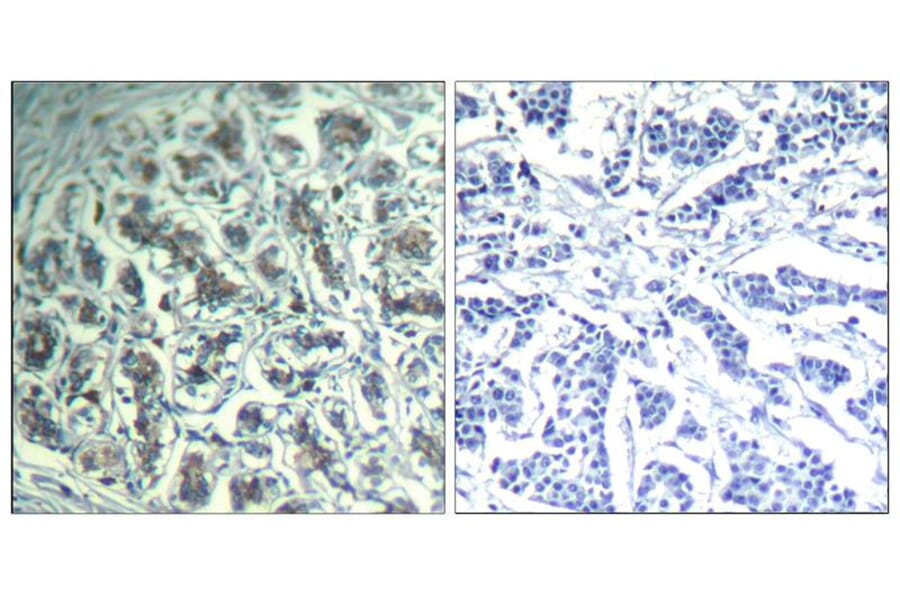Immunohistochemistry - PLCg1 (Ab-771) Antibody from Signalway Antibody (21523) - Antibodies.com