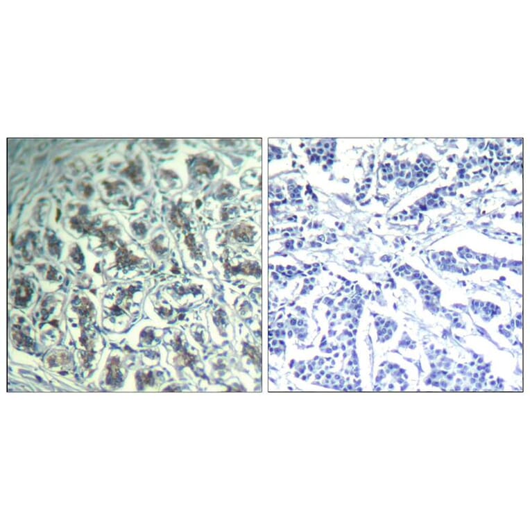 Immunohistochemistry - PLCg1 (Ab-771) Antibody from Signalway Antibody (21523) - Antibodies.com