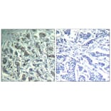 Immunohistochemistry - PLCg1 (Ab-771) Antibody from Signalway Antibody (21523) - Antibodies.com