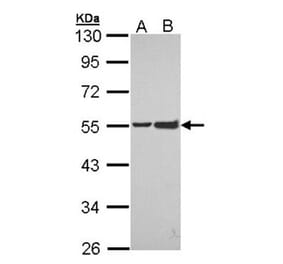 EPH receptor A8 antibody from Signalway Antibody (22193) - Antibodies.com