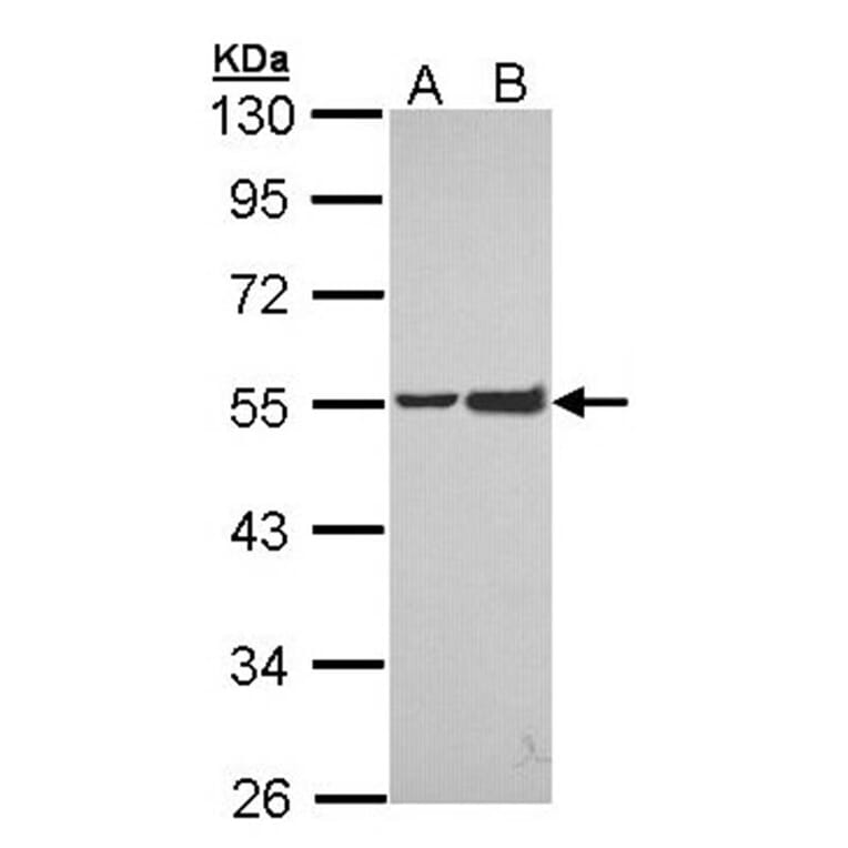 EPH receptor A8 antibody from Signalway Antibody (22193) - Antibodies.com