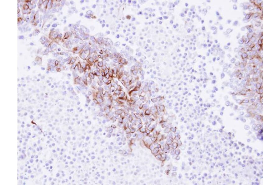 Immunohistochemistry - EPH receptor A8 antibody from Signalway Antibody (22193) - Antibodies.com