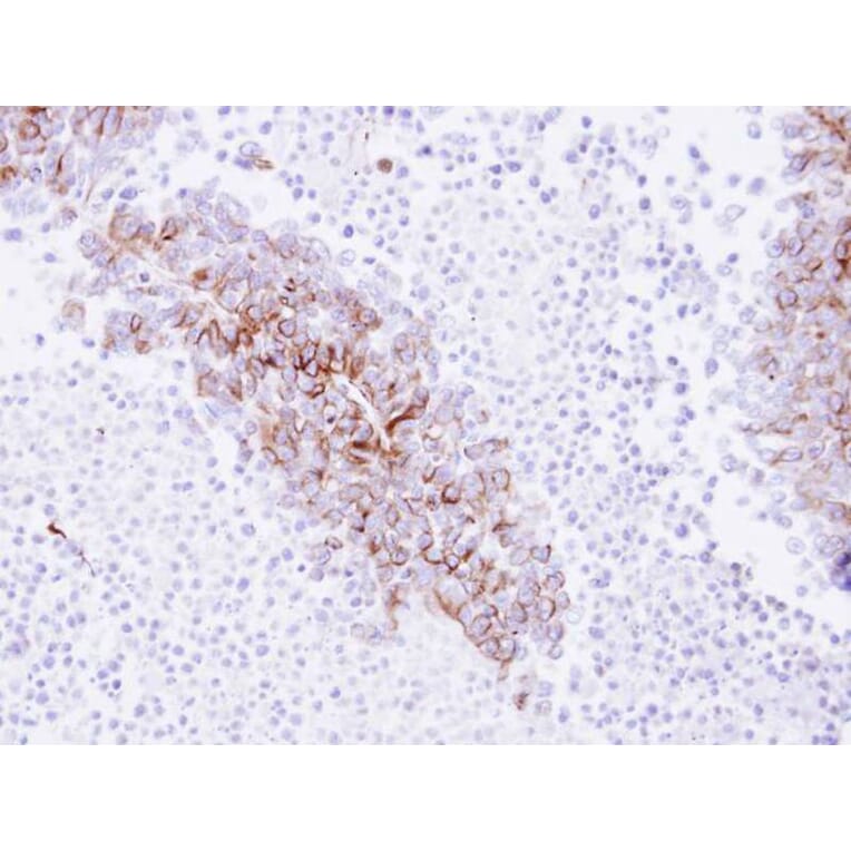 Immunohistochemistry - EPH receptor A8 antibody from Signalway Antibody (22193) - Antibodies.com