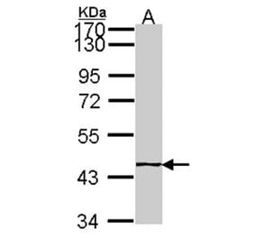 EPH receptor A8 antibody from Signalway Antibody (22194) - Antibodies.com