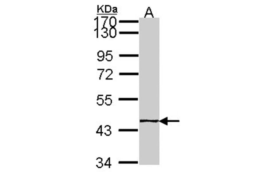 EPH receptor A8 antibody from Signalway Antibody (22194) - Antibodies.com