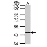 EPH receptor A8 antibody from Signalway Antibody (22194) - Antibodies.com