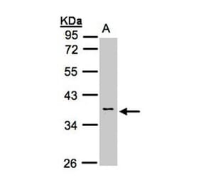 Calsequestrin-2 antibody from Signalway Antibody (22301) - Antibodies.com