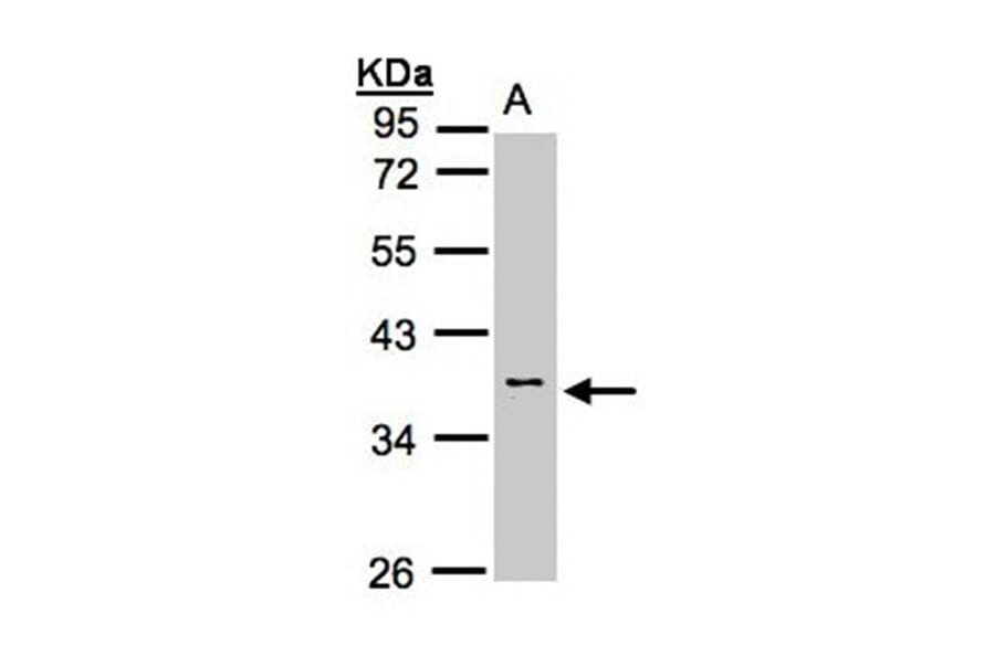 Calsequestrin-2 antibody from Signalway Antibody (22301) - Antibodies.com
