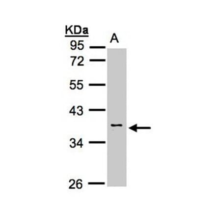 Calsequestrin-2 antibody from Signalway Antibody (22301) - Antibodies.com
