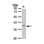 Calsequestrin-2 antibody from Signalway Antibody (22301) - Antibodies.com