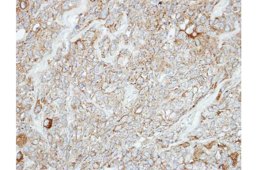 Immunohistochemistry - Protocadherin-1 antibody from Signalway Antibody (22346) - Antibodies.com