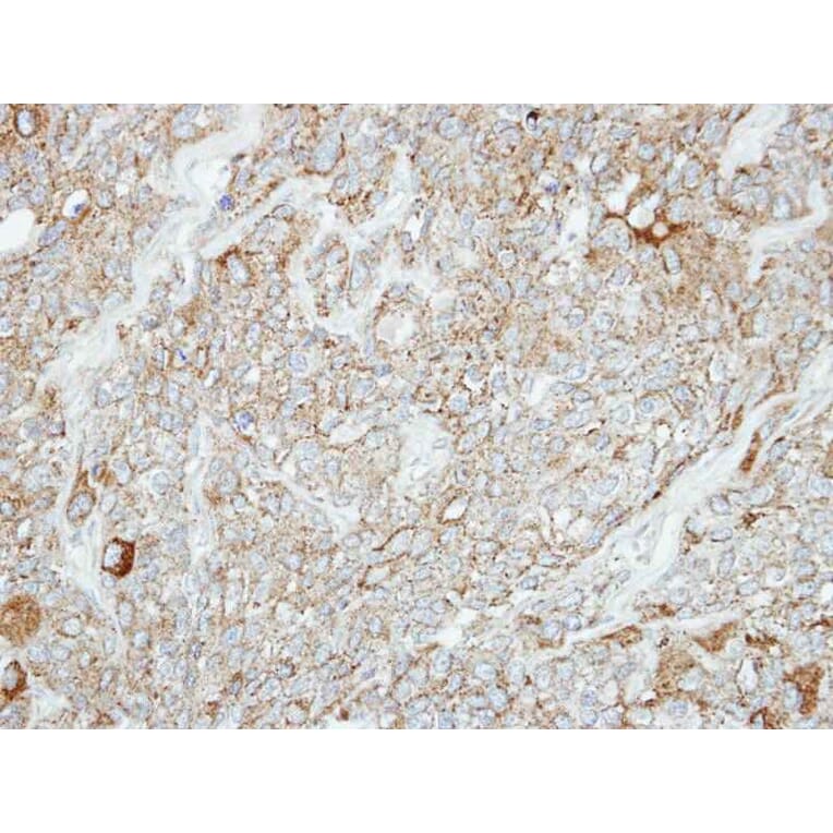 Immunohistochemistry - Protocadherin-1 antibody from Signalway Antibody (22346) - Antibodies.com