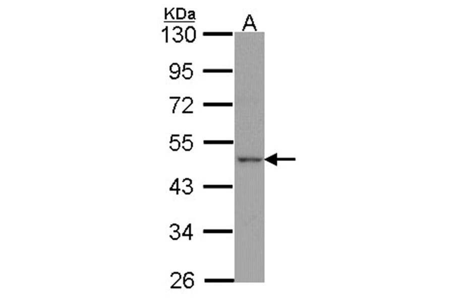 Apelin receptor antibody from Signalway Antibody (22822) - Antibodies.com