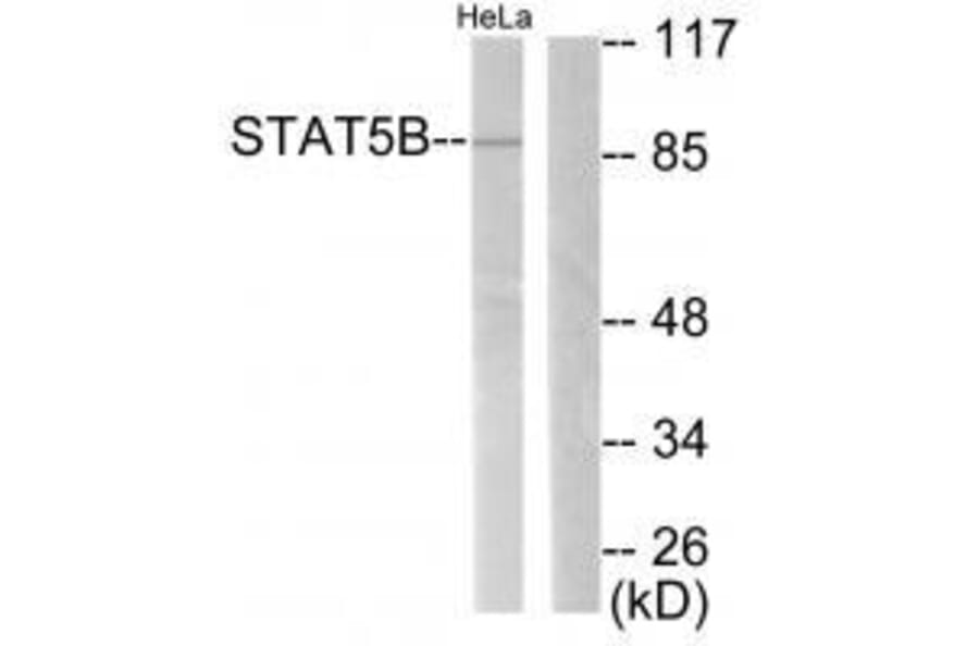 Western blot - STAT5B (Ab-731) Antibody from Signalway Antibody (33126) - Antibodies.com