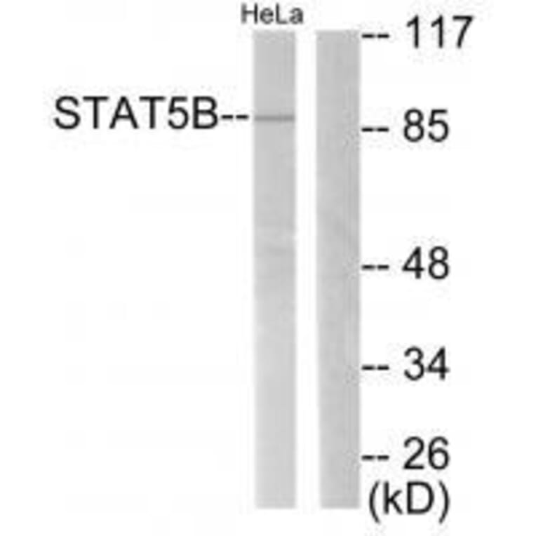 Western blot - STAT5B (Ab-731) Antibody from Signalway Antibody (33126) - Antibodies.com