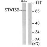 Western blot - STAT5B (Ab-731) Antibody from Signalway Antibody (33126) - Antibodies.com