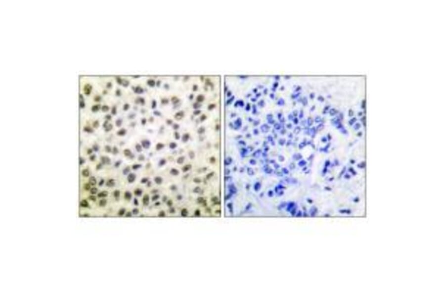 Immunohistochemistry - STAT5B (Ab-731) Antibody from Signalway Antibody (33126) - Antibodies.com