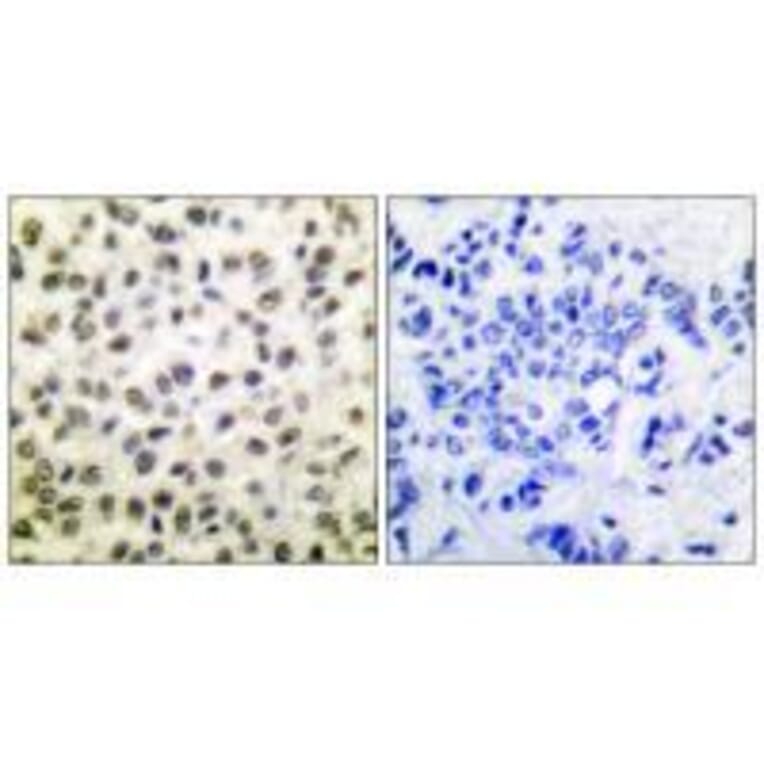 Immunohistochemistry - STAT5B (Ab-731) Antibody from Signalway Antibody (33126) - Antibodies.com