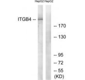 Western blot - ITGB4 (Ab-1510) Antibody from Signalway Antibody (33169) - Antibodies.com