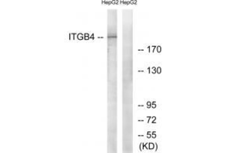 Western blot - ITGB4 (Ab-1510) Antibody from Signalway Antibody (33169) - Antibodies.com
