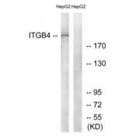 Western blot - ITGB4 (Ab-1510) Antibody from Signalway Antibody (33169) - Antibodies.com