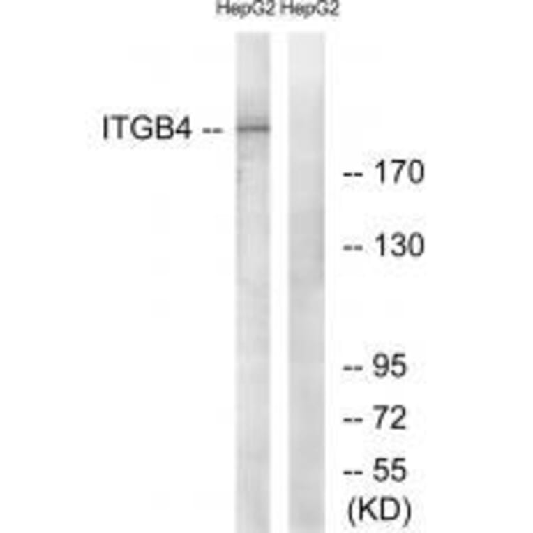 Western blot - ITGB4 (Ab-1510) Antibody from Signalway Antibody (33169) - Antibodies.com