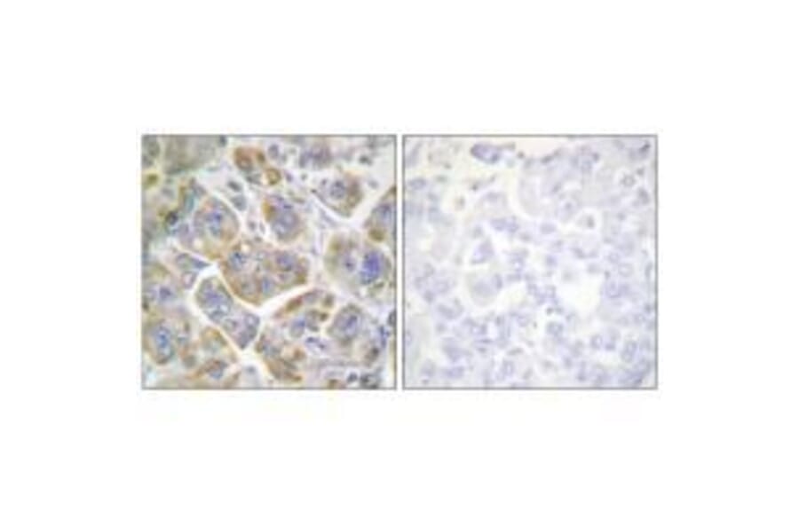 Immunohistochemistry - ITGB4 (Ab-1510) Antibody from Signalway Antibody (33169) - Antibodies.com