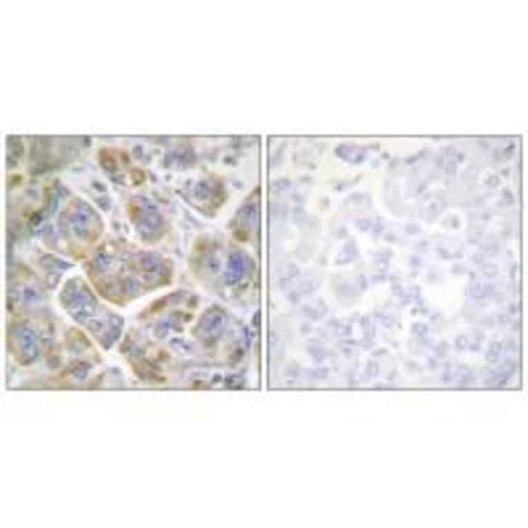 Immunohistochemistry - ITGB4 (Ab-1510) Antibody from Signalway Antibody (33169) - Antibodies.com