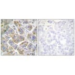 Immunohistochemistry - ITGB4 (Ab-1510) Antibody from Signalway Antibody (33169) - Antibodies.com