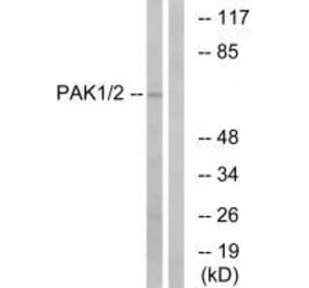 Western blot - PAK1/2 (Ab-199) Antibody from Signalway Antibody (33172) - Antibodies.com
