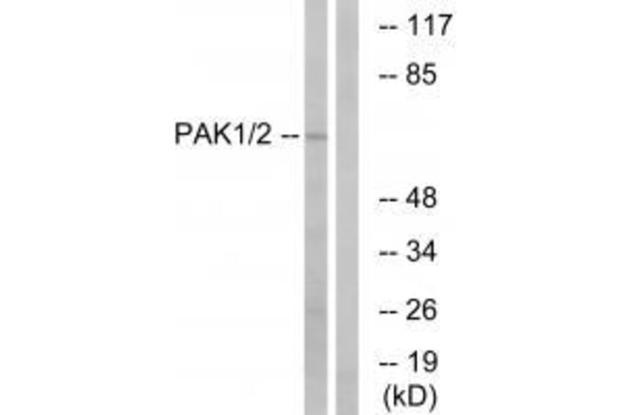 Western blot - PAK1/2 (Ab-199) Antibody from Signalway Antibody (33172) - Antibodies.com