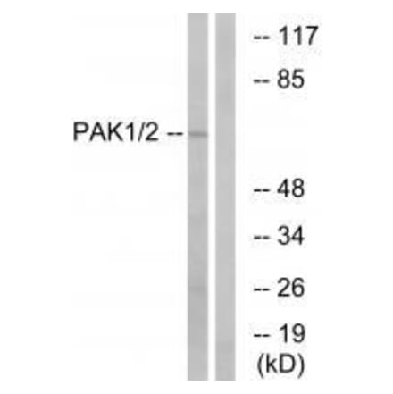 Western blot - PAK1/2 (Ab-199) Antibody from Signalway Antibody (33172) - Antibodies.com