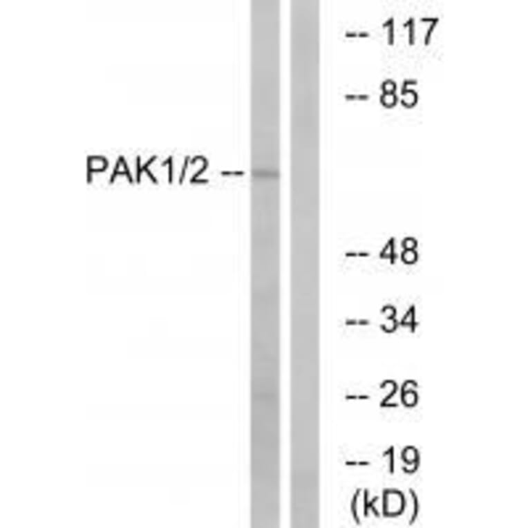 Western blot - PAK1/2 (Ab-199) Antibody from Signalway Antibody (33172) - Antibodies.com