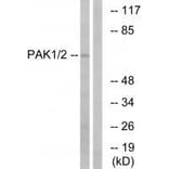 Western blot - PAK1/2 (Ab-199) Antibody from Signalway Antibody (33172) - Antibodies.com