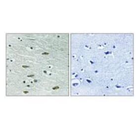 Immunohistochemistry - IGF1R (Ab-1346) Antibody from Signalway Antibody (33217) - Antibodies.com