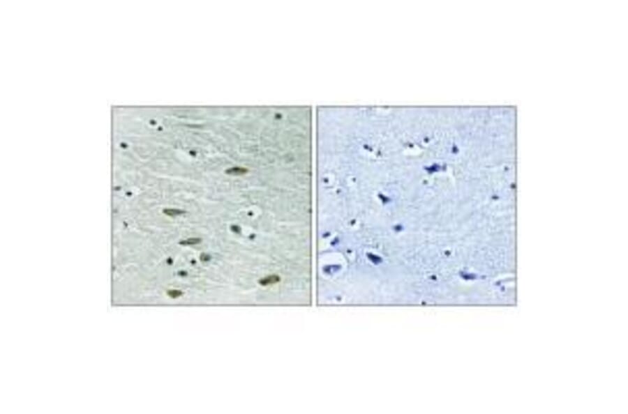 Immunohistochemistry - IGF1R (Ab-1346) Antibody from Signalway Antibody (33217) - Antibodies.com