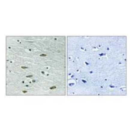 Immunohistochemistry - IGF1R (Ab-1346) Antibody from Signalway Antibody (33217) - Antibodies.com