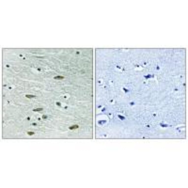 Immunohistochemistry - IGF1R (Ab-1346) Antibody from Signalway Antibody (33217) - Antibodies.com