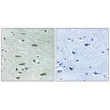 Immunohistochemistry - IGF1R (Ab-1346) Antibody from Signalway Antibody (33217) - Antibodies.com