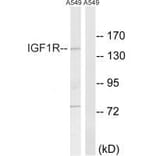 Western blot - IGF1R (Ab-1346) Antibody from Signalway Antibody (33217) - Antibodies.com