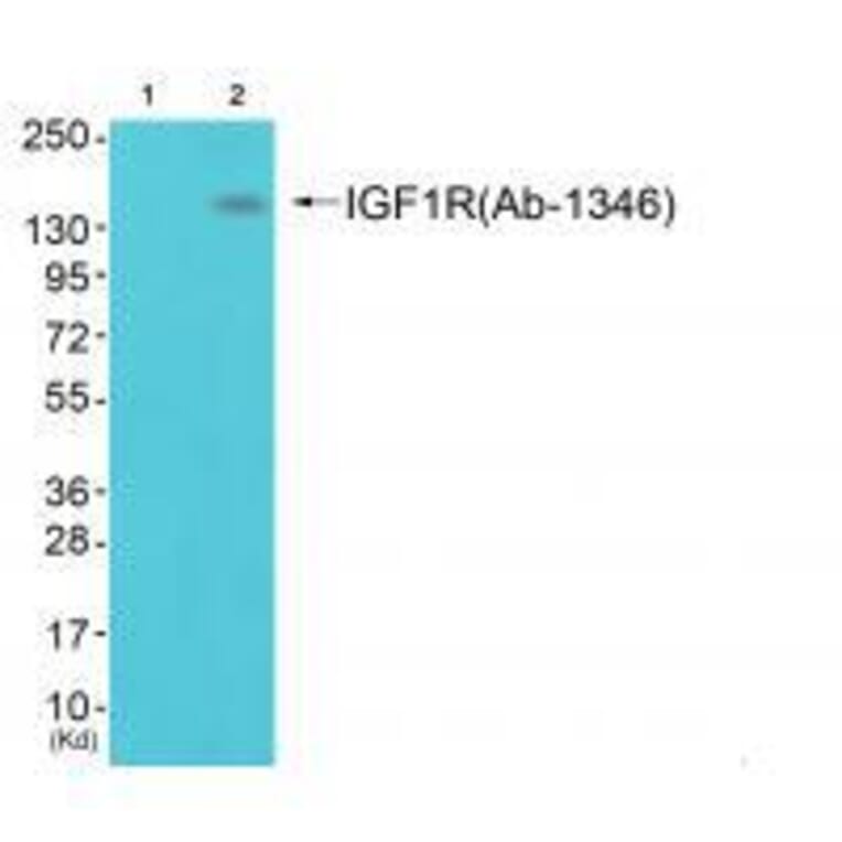 Western blot - IGF1R (Ab-1346) Antibody from Signalway Antibody (33217) - Antibodies.com