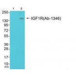 Western blot - IGF1R (Ab-1346) Antibody from Signalway Antibody (33217) - Antibodies.com