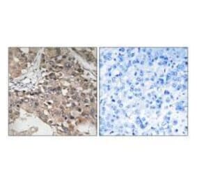 Immunohistochemistry - MAP3K7 (Ab-187) Antibody from Signalway Antibody (33234) - Antibodies.com