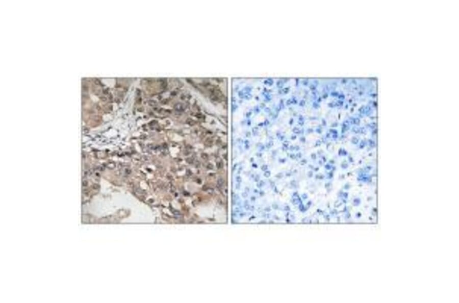Immunohistochemistry - MAP3K7 (Ab-187) Antibody from Signalway Antibody (33234) - Antibodies.com