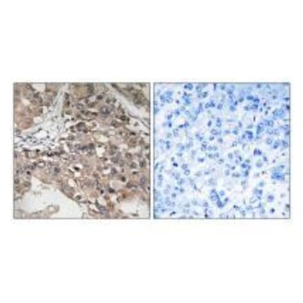 Immunohistochemistry - MAP3K7 (Ab-187) Antibody from Signalway Antibody (33234) - Antibodies.com