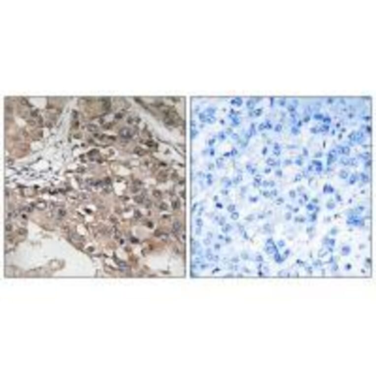 Immunohistochemistry - MAP3K7 (Ab-187) Antibody from Signalway Antibody (33234) - Antibodies.com